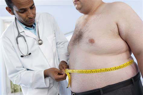 Obesità, un problema non solo estetico ma anche di salute